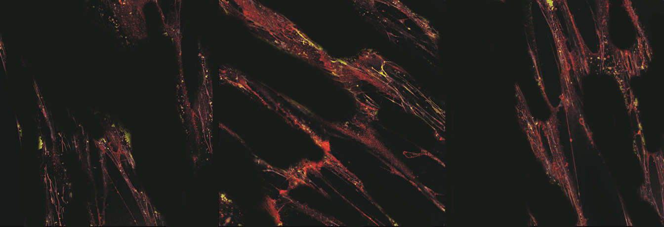 Mesenchymal stem cells